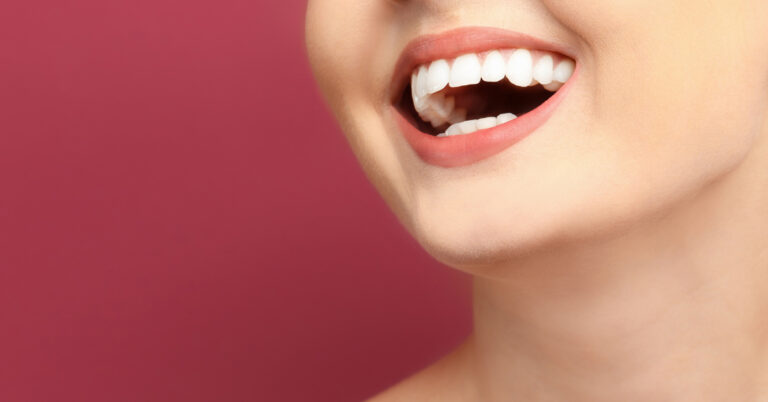 clareamento dental em cotia